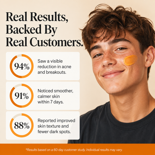 SkinReset™ — Acne & Redness Recovery Ritual