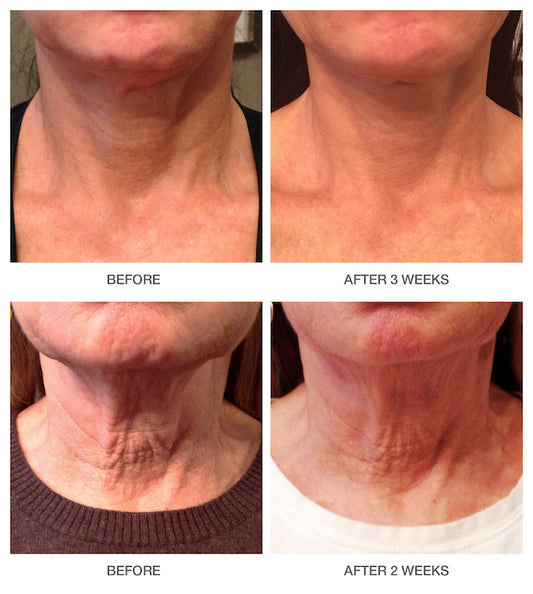 Skin Tightening Cream For Deep Moisture and Anti-Aging