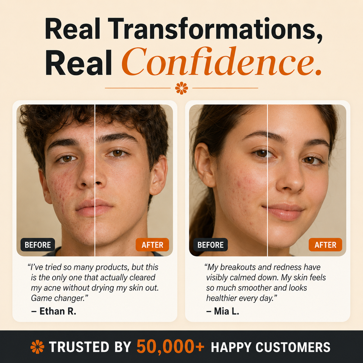 SkinReset™ — Acne & Redness Recovery Ritual
