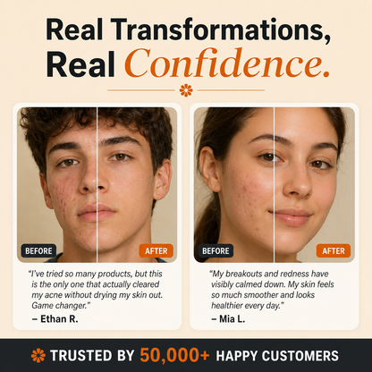 SkinReset™ — Acne & Redness Recovery Ritual