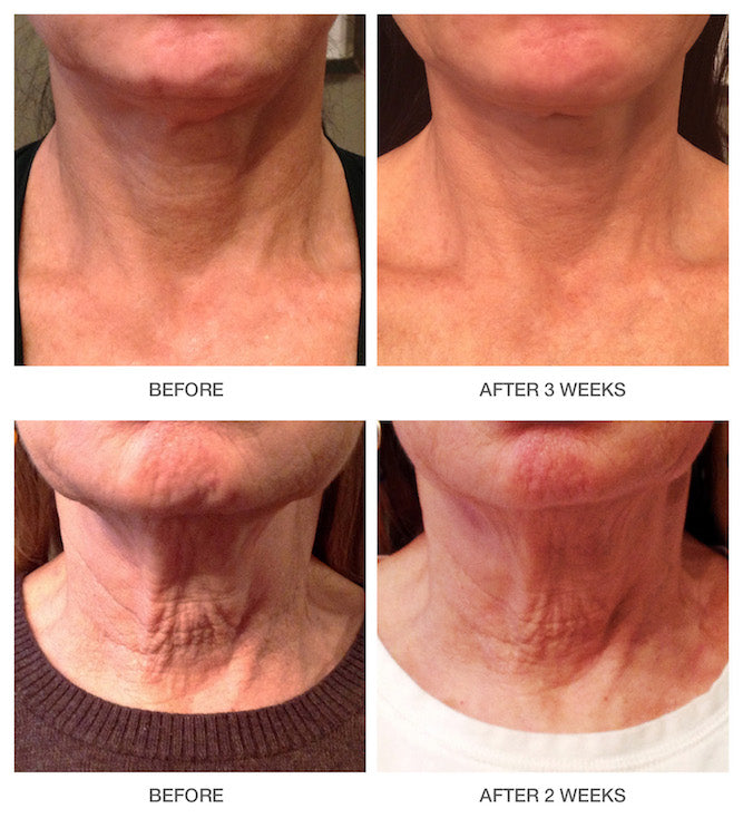 Skin Tightening Cream For Deep Moisture and Anti-Aging
