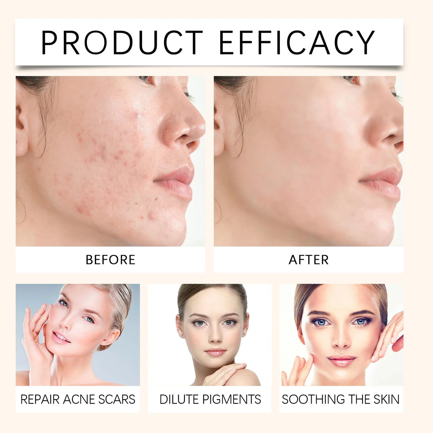 SkinReset™ — Acne & Redness Recovery Ritual
