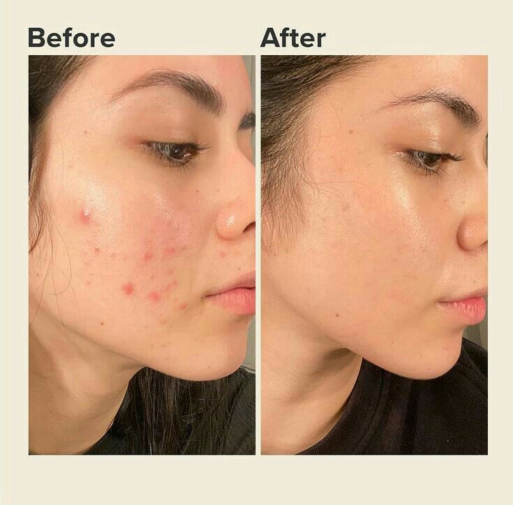 Collagen Overnight Beauty Mask - Deep Skin Renewal & Hydration